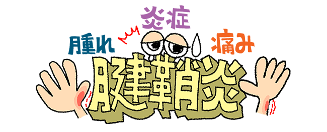 腱鞘炎