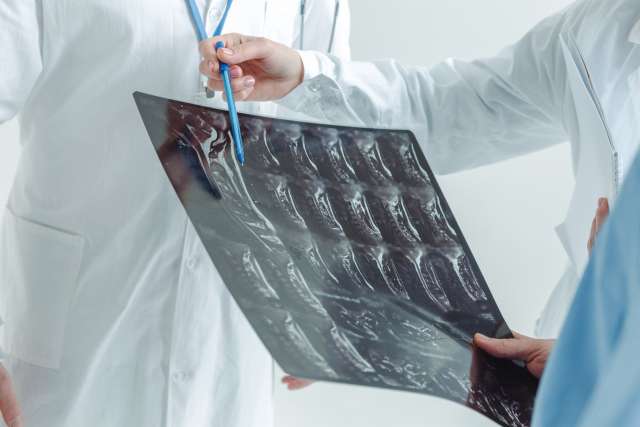 レントゲンを見る医師の手